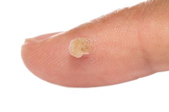 Uso Skincell Pro, en caso de que, se ten manchas na pel, moles, verrugas, relacionada coa idade pel cambios