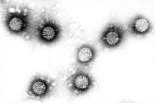 Papilomavirus humano